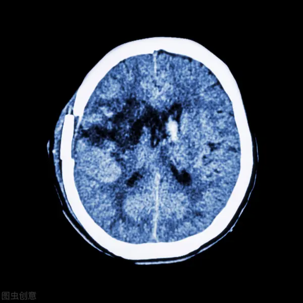 瞳孔放大代表死亡吗(为什么瞳孔放大代表死亡?)-第7张图片-万福百科