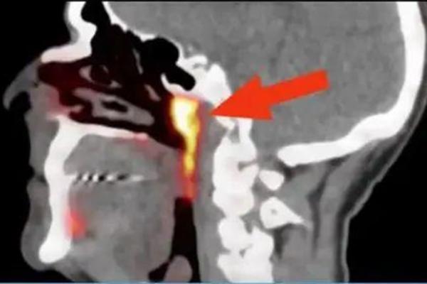 科学家在人体内发现未知新器官,这器官有什么用?-第2张图片-万福百科