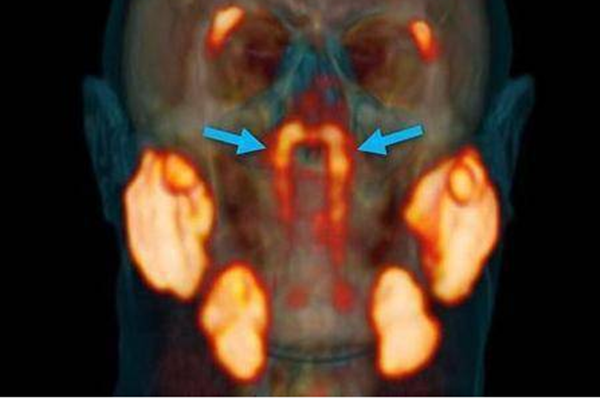 科学家在人体内发现未知新器官,这器官有什么用?-第3张图片-万福百科