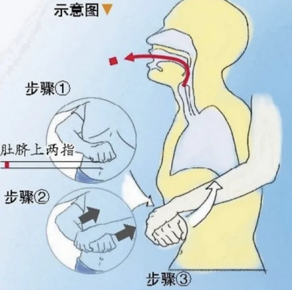 男子闯入幼儿园砍伤师生被抓,如何加强幼儿园的安全保护?-第33张图片-万福百科