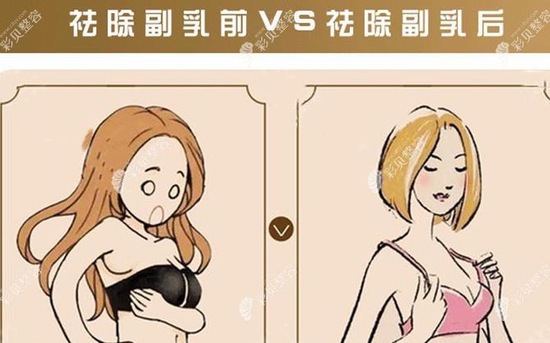 附乳祛除手术费用 附乳祛除：告别烦恼，重获自信-第1张图片-万福百科