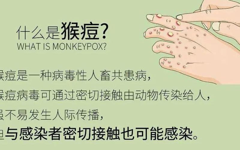 猴痘百科：了解病因、症状和预防 *** -第1张图片-万福百科