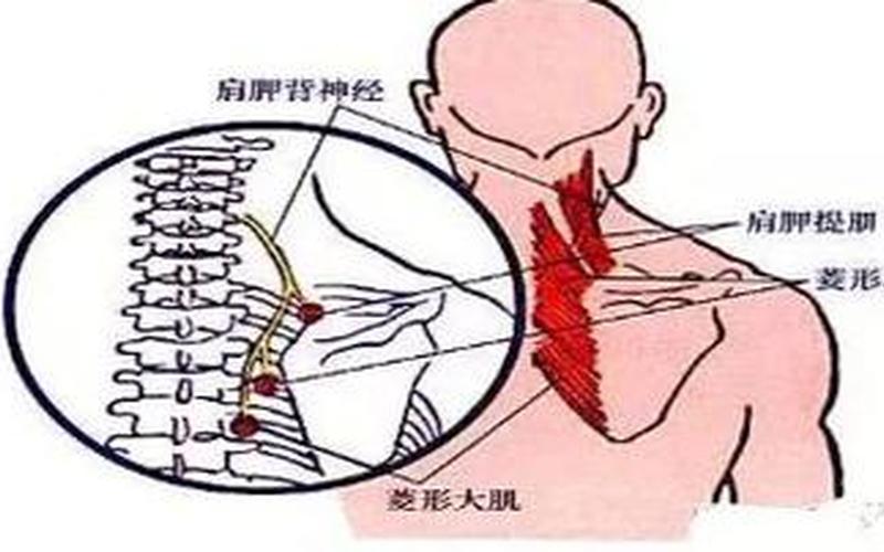 景组词-颈部疼痛的原因与治疗 *** 探究-第1张图片-万福百科