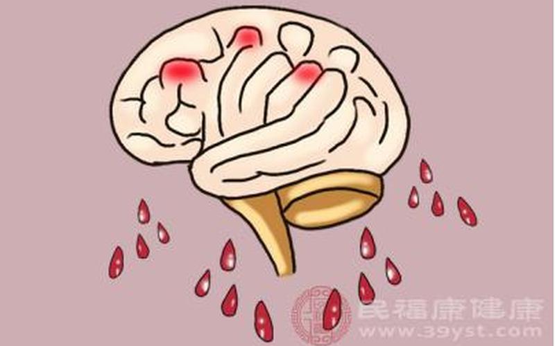 脑死亡是什么意思-第1张图片-万福百科